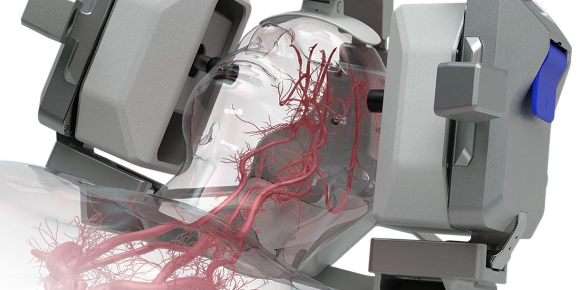 NovaSignal’s AI-Guided Robotic Platform Aims To Change The Diagnosis Of Stroke