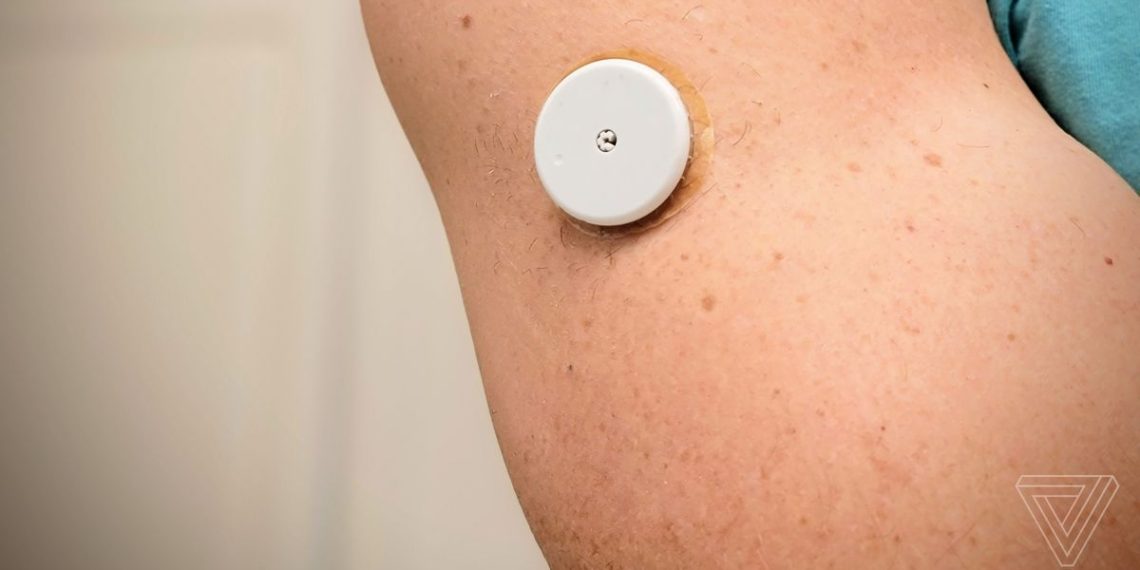 Levels Health review: optimize your fitness with a $400 glucose tracker