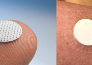 MyLife Technologies, a Dutch medtech startup developing ceramic vaccine patches, secures €3.5M