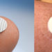 MyLife Technologies, a Dutch medtech startup developing ceramic vaccine patches, secures €3.5M