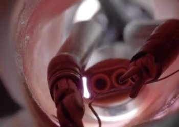 YOUR HEALTH: Using robots to treat the toughest of cancers