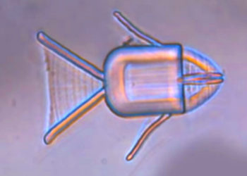 Tiny Shape-Shifting Microrobots Can Locate Cancer Cells. With Magnets?