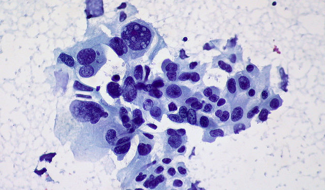 Startup Mythic Therapeutics emerges with $103M to control fate of ADC cancer drugs