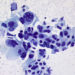 Startup Mythic Therapeutics emerges with $103M to control fate of ADC cancer drugs