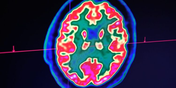 Flagship to launch a new startup focused on neurodegenerative conditions