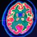 Flagship to launch a new startup focused on neurodegenerative conditions