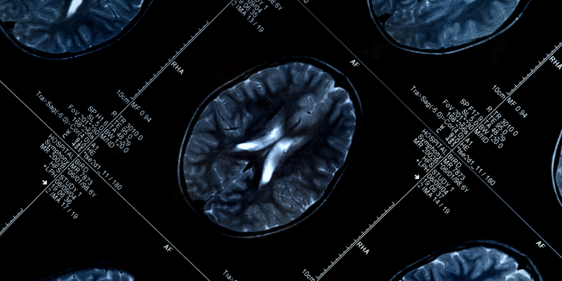 A True Differentiator for BNPL