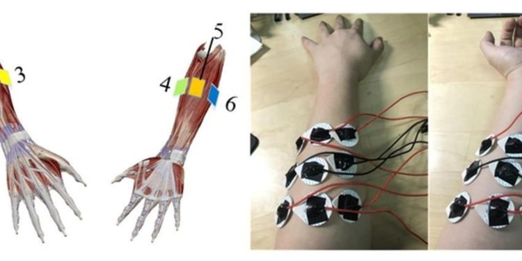 Hybrid Machine-Learning Approach Gives a Hand to Prosthetic-Limb Gesture Accuracy
