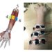 Hybrid Machine-Learning Approach Gives a Hand to Prosthetic-Limb Gesture Accuracy
