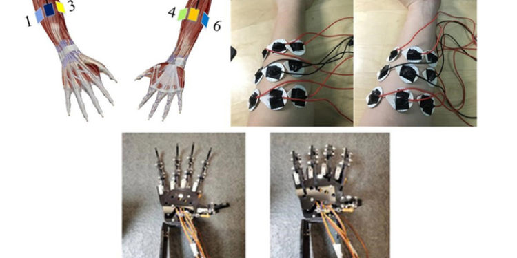Researchers create new learning model for prosthetic limbs