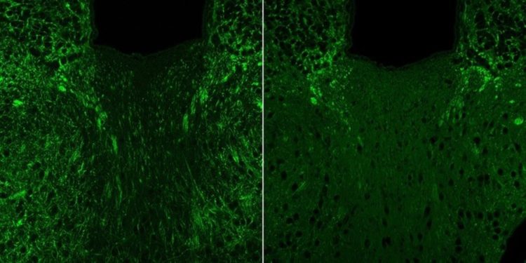 A Microbial Compound in the Gut Leads to Anxious Behaviors in Mice