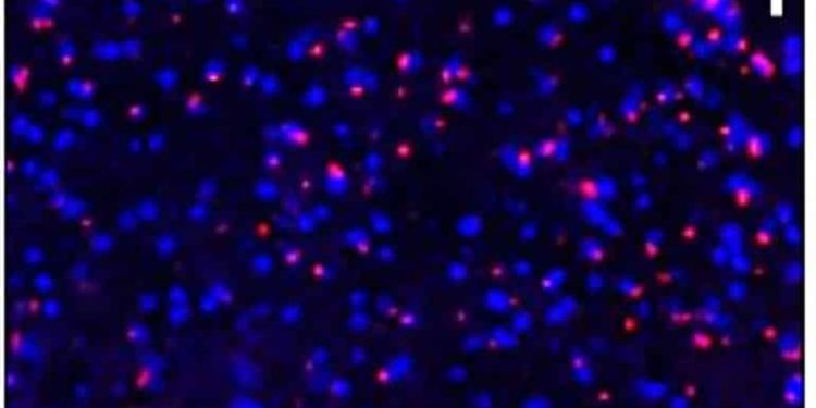 Iron Accumulation Linked With Age-Related Cognitive Decline