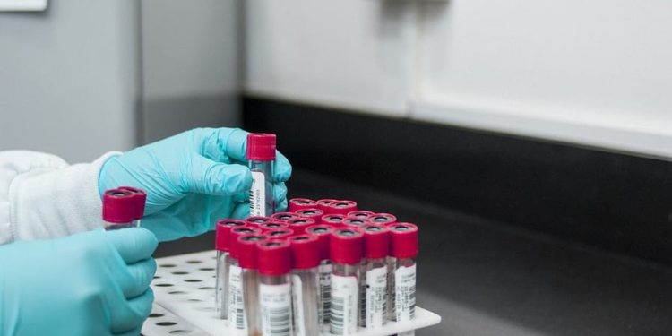 Scopio Labs Closes $50M Investment to Analyze Blood Samples With New Tech