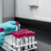 Scopio Labs Closes $50M Investment to Analyze Blood Samples With New Tech