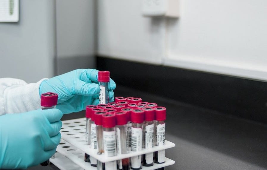 Scopio Labs Closes $50M Investment to Analyze Blood Samples With New Tech
