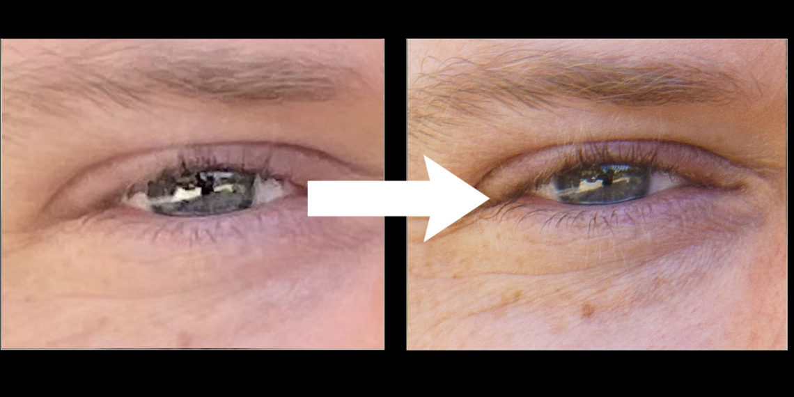 Startup Uses Anamorphic Lenses to Improve Smartphone Image Quality