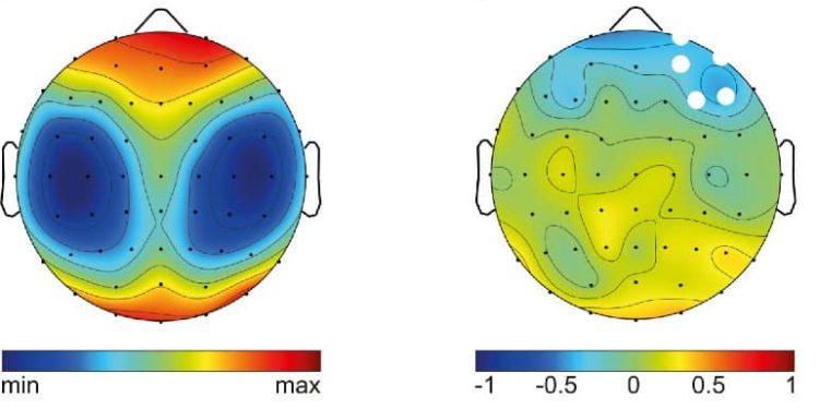 Brain Waves During Sleep Can Determine Risk Taking Behaviors