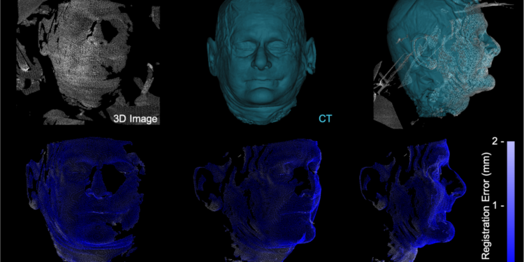 Zeta Surgical’s Image-Guided Surgery: How Does It Work? Startup Raises $5.2M for Its Ventures