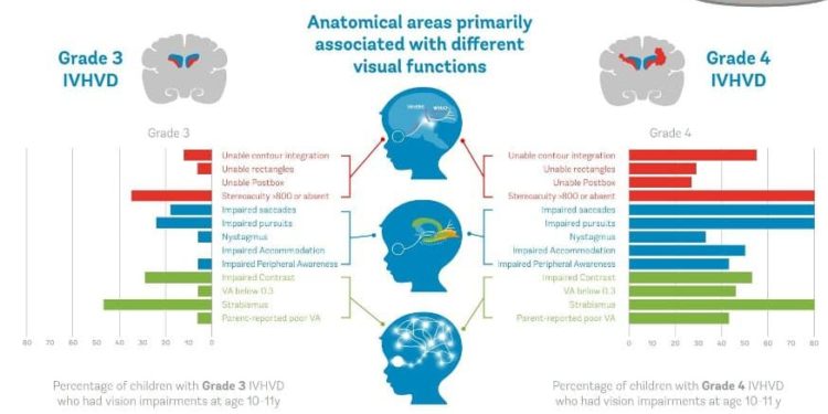 Brain Bleeds in Babies’ First Year Can Lead to Long-Term Vision Problems