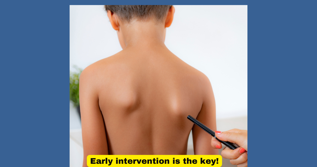 Growing with Scoliosis? Singapore Parents, Guide Your Child with Physiotherapy and BMJ Expertise