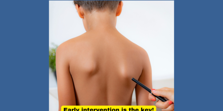 Growing with Scoliosis? Singapore Parents, Guide Your Child with Physiotherapy and BMJ Expertise