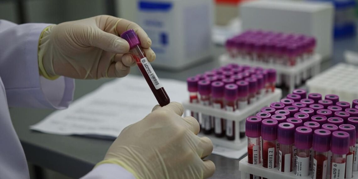 Revolutionizing Alzheimer’s Prevention: Zentara’s Groundbreaking Framework to Combat Dementia